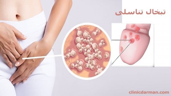  تبخال تناسلی بدتر است یا زگیل تناسلی؟