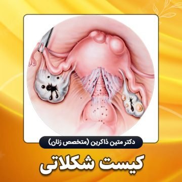  آیا جوش واژن خطرناک است؟