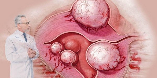  آیا جوش واژن خطرناک است؟