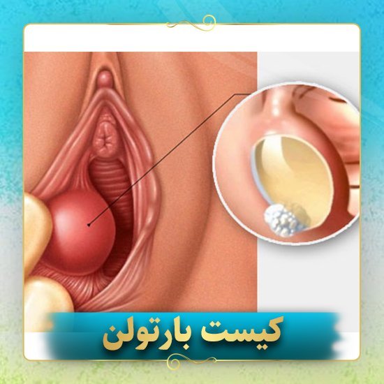  آیا جوش واژن خطرناک است؟