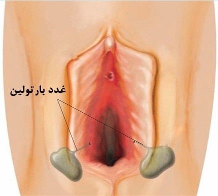 آیا جوش واژن خطرناک است؟