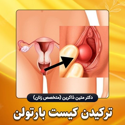 آیا جوش واژن خطرناک است؟