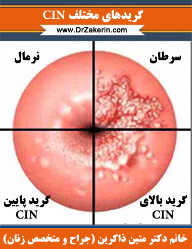  آیا کولپوسکوپی درد دارد؟