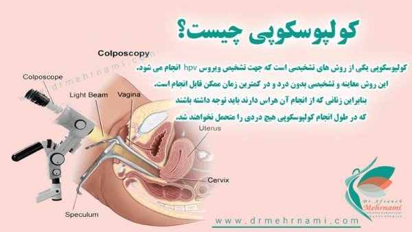  آیا کولپوسکوپی درد دارد؟