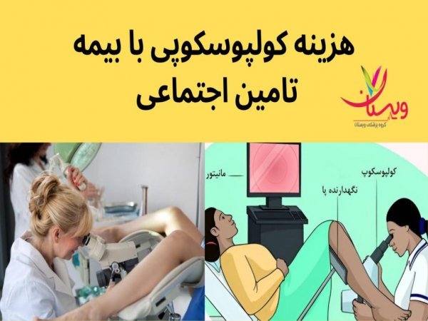  آیا کولپوسکوپی درد دارد؟