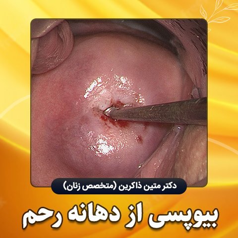  آیا کولپوسکوپی درد دارد؟