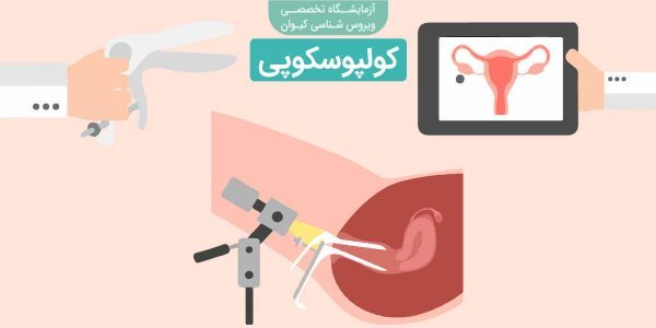  آیا کولپوسکوپی درد دارد؟