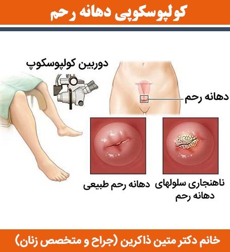  آیا کولپوسکوپی درد دارد؟