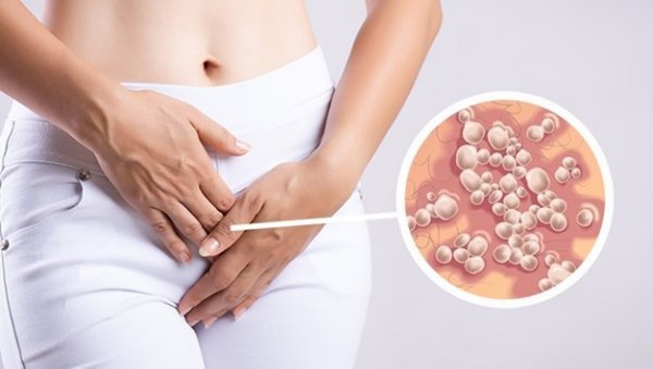  آیا تبخال تناسلی باعث تب می‌شود؟