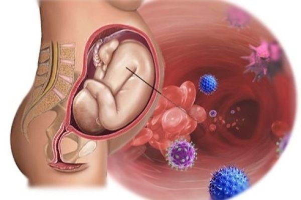  آیا تبخال تناسلی باعث تب می‌شود؟