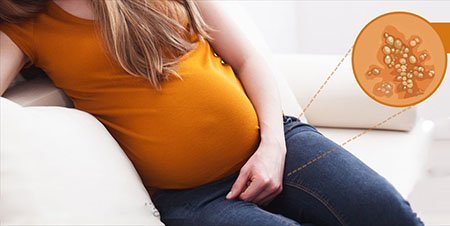  آیا تبخال تناسلی باعث تب می‌شود؟