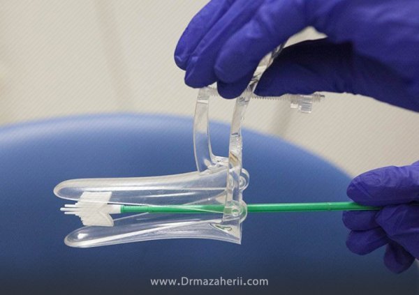  آیا واژینیسموس مانع بارداری می‌شود؟