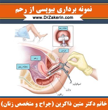  آیا تست پاپ اسمیر درد دارد؟