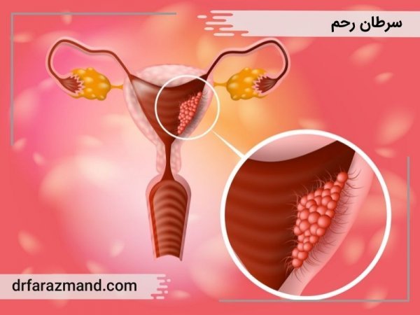  آیا تست پاپ اسمیر درد دارد؟