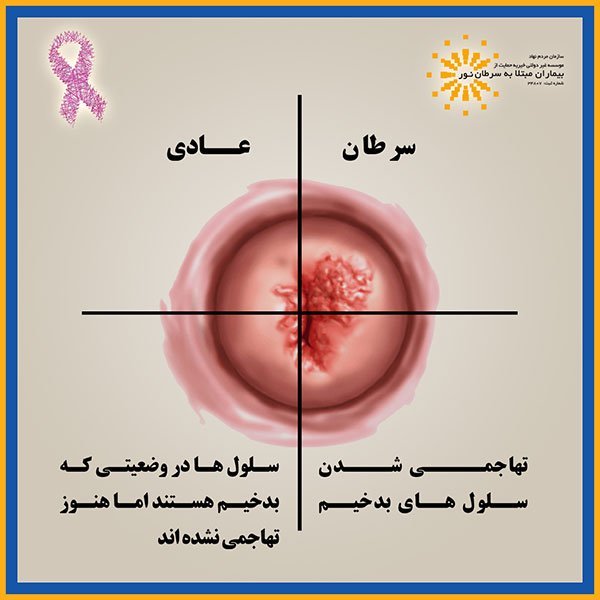  آیا تست پاپ اسمیر درد دارد؟