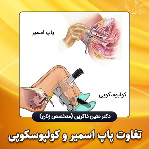  آیا تست پاپ اسمیر درد دارد؟