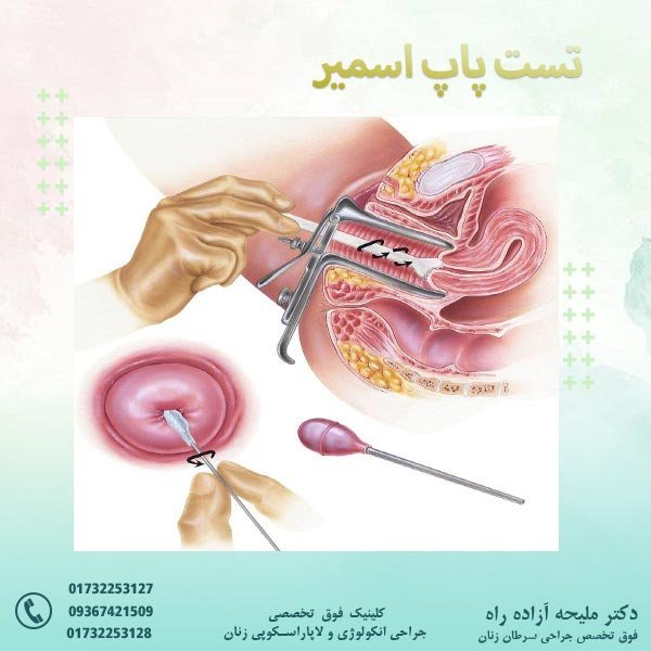 چند روز بعد از پاپ اسمیر می‌توان رابطه جنسی داشت؟