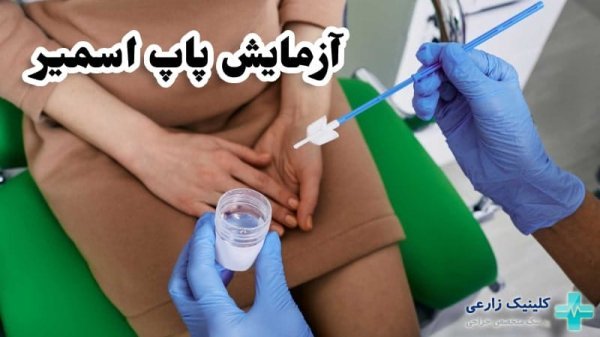  چند روز بعد از پاپ اسمیر می‌توان رابطه جنسی داشت؟