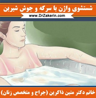  بعد از رابطه مقعدی چه کاری انجام دهیم؟