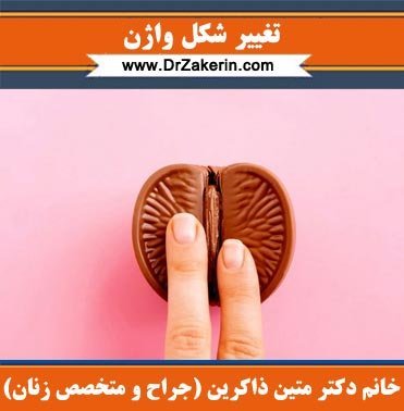 آیا بعد از رابطه واژن به حالت اول برمی‌گردد؟