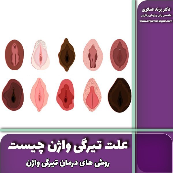  آیا بعد از رابطه واژن به حالت اول برمی‌گردد؟