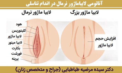  چه چیزهایی باعث تنگ شدن واژن می‌شود؟