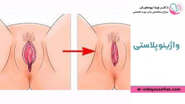  چه چیزهایی باعث تنگ شدن واژن می‌شود؟