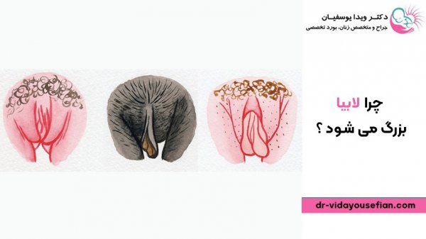  چه چیزهایی باعث تنگ شدن واژن می‌شود؟