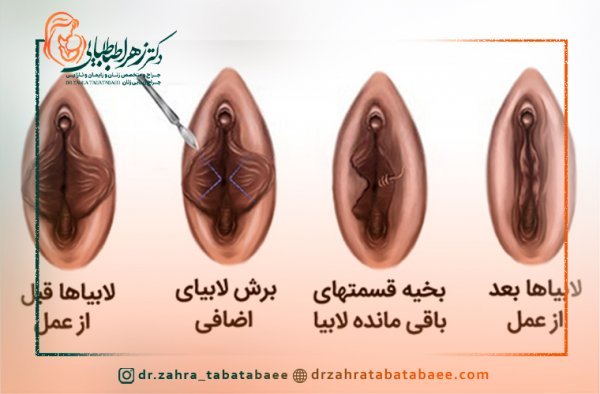  چه چیزهایی باعث تنگ شدن واژن می‌شود؟