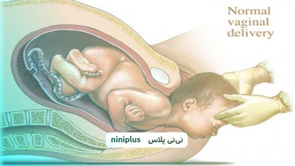  آیا زایمان طبیعی باعث گشادی واژن میشود؟