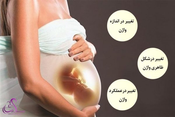  آیا زایمان طبیعی باعث گشادی واژن میشود؟