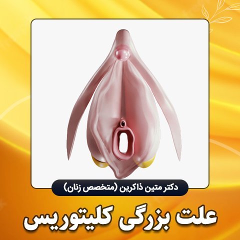 چه چیزی باعث بزرگ شدن واژن می‌شود؟