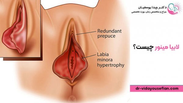  چه چیزی باعث بزرگ شدن واژن می‌شود؟
