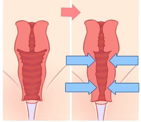  آیا رابطه جنسی زیاد باعث گشادی واژن می‌شود؟