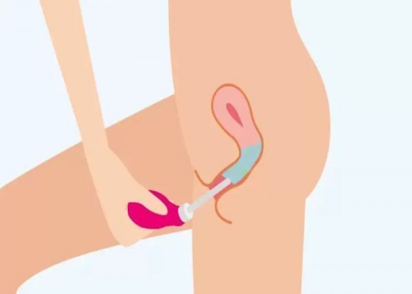  واژن را با چی خشک کنیم؟