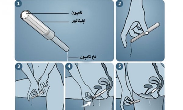  بهداشت واژن بعد از رابطه جنسی(سکس) + تفاوت تامپون با کاپ قاعدگی