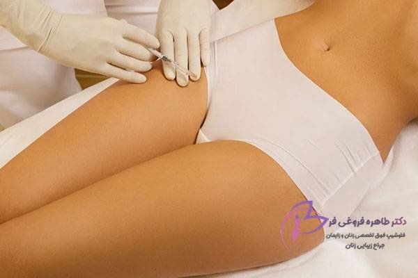  آیا کربوکسی تراپی واژن درد دارد؟