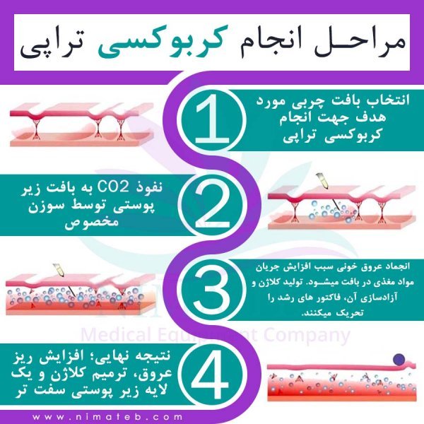  آیا کربوکسی تراپی واژن درد دارد؟