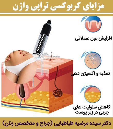  آیا کربوکسی تراپی واژن درد دارد؟