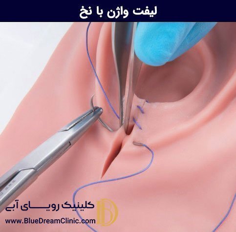 در چه صورتی نیاز به تنگ کردن واژن داریم؟