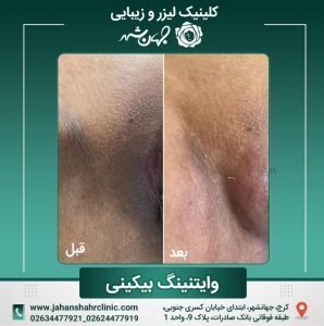  در چه صورتی نیاز به تنگ کردن واژن داریم؟