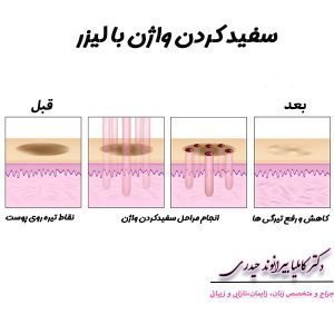  در چه صورتی نیاز به تنگ کردن واژن داریم؟