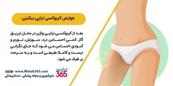  در چه صورتی نیاز به تنگ کردن واژن داریم؟
