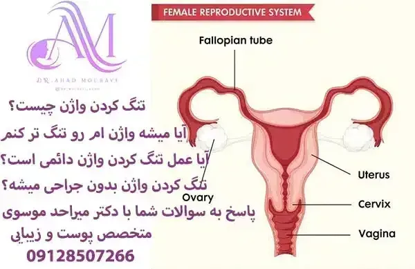  در چه صورتی نیاز به تنگ کردن واژن داریم؟