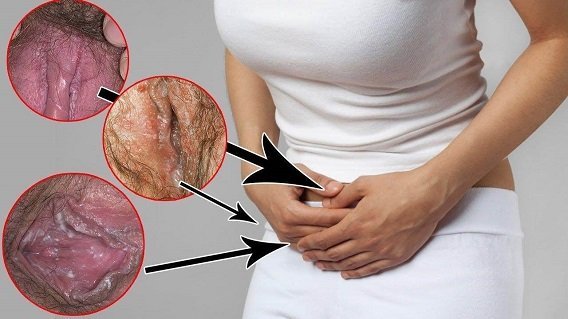 چرا واژن پاره می‌شود؟