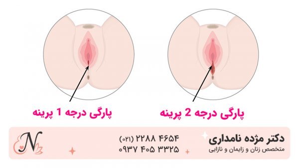  چرا واژن پاره می‌شود؟