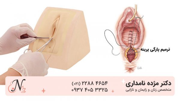  چرا واژن پاره می‌شود؟