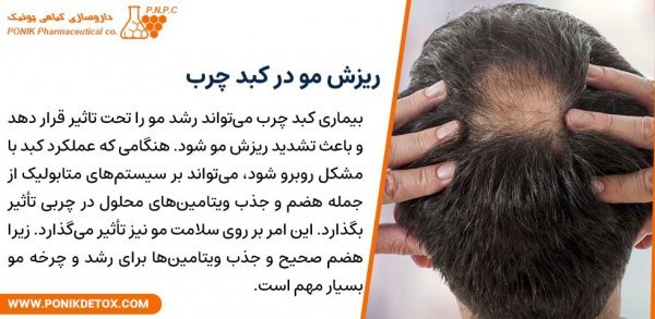  آیا کبد چرب باعث چاقی می‌شود؟