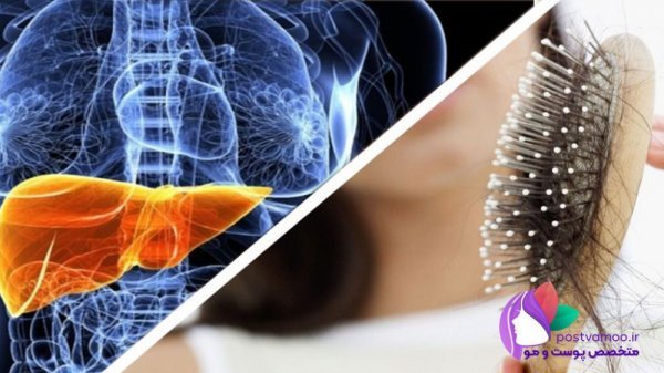  آیا کبد چرب باعث چاقی می‌شود؟