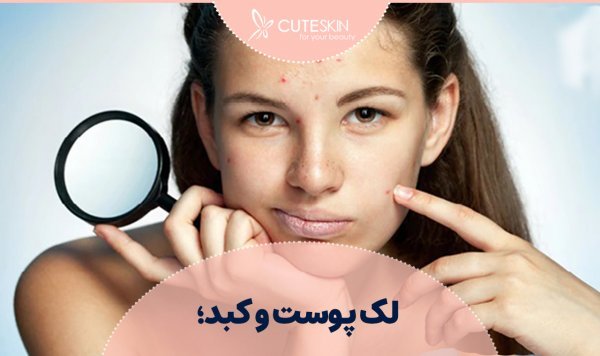  علائم خطرناک کبد چرب